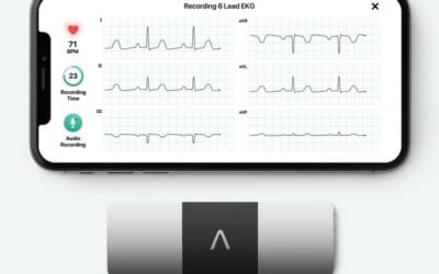 Palpitations Monitor